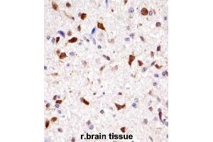 Immunohistochemistry (IHC) image for anti-Homeobox A7 (HOXA7) antibody (ABIN2998012) (HOXA7 抗体)