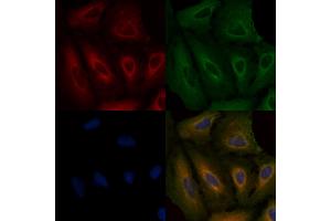 ABIN6264219 and ABIN6279663 staining  cells by IF/ICC. (PIK3R6 抗体  (C-Term))