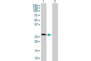 Western Blot analysis of ZNF266 expression in transfected 293T cell line by ZNF266 MaxPab polyclonal antibody. (ZNF266 抗体  (AA 1-263))