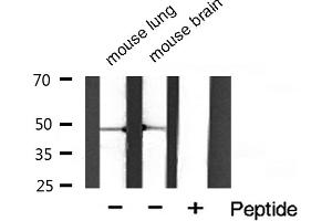 Western blot analysis of Phospho-HDAC3 (Ser424) Antibody expression in mouse lung and mouse brain tissues lysates. (HDAC3 抗体  (pSer424))
