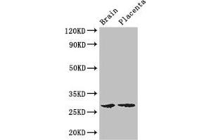 Western Blot Positive WB detected in: Mouse brain tissue, Human placenta tissue All lanes: FBXL22 antibody at 3 μg/mL Secondary Goat polyclonal to rabbit IgG at 1/50000 dilution Predicted band size: 28 kDa Observed band size: 28 kDa (FBXL22 抗体  (AA 123-229))