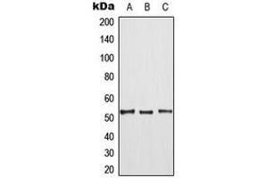 Western blot analysis of TPL2 (pT290) expression in HepG2 (A), mouse liver (B), rat liver (C) whole cell lysates. (MAP3K8 抗体  (pSer290))