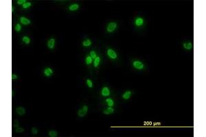 Image no. 3 for anti-TATA Box Binding Protein Associated Factor 11 (TAF11) (AA 158-211) antibody (ABIN598958) (TAF11 抗体  (AA 158-211))
