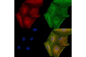 ABIN6261126 and ABIN6277912 staining  cells by IF/ICC.