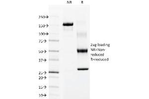 SDS-PAGE Analysis Purified Cytokeratin 15 Mouse Monoclonal Antibody (LHK15). (KRT15 抗体  (C-Term))