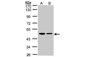 WB Image Sample(30 ug whole cell lysate) A:A431, B:H1299 10% SDS PAGE antibody diluted at 1:1000 (ERP44 抗体)