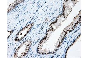 Immunohistochemical staining of paraffin-embedded Kidney tissue using anti-APP mouse monoclonal antibody. (APP 抗体)
