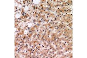 Immunohistochemical analysis of IL-19 staining in human liver formalin fixed paraffin embedded tissue section. (IL-19 抗体)