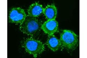 IF analysis of Moesin/MSN using anti-Moesin/MSN antibody (ABIN7600379). (Moesin 抗体  (AA 184-568))