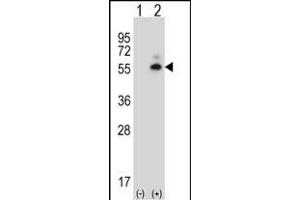 Western Blotting (WB) image for anti-Calcium/calmodulin-Dependent Protein Kinase II delta (CAMK2D) (AA 221-250) antibody (ABIN657721)