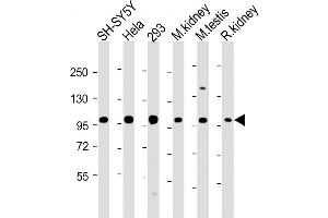 All lanes : Anti-PG Antibody (N-Term) at 1:2000 dilution Lane 1: SH-SY5Y whole cell lysate Lane 2: Hela whole cell lysate Lane 3: 293 whole cell lysate Lane 4: mouse kidney lysate Lane 5: mouse testis lysate Lane 6: rat kidney lysate Lysates/proteins at 20 μg per lane. (PGAP1 抗体  (AA 90-122))