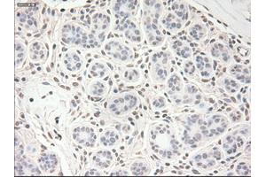 Immunohistochemical staining of paraffin-embedded breast tissue using anti-VEGF mouse monoclonal antibody.