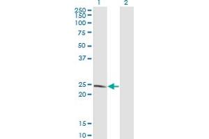 Western Blot analysis of LYPLA1 expression in transfected 293T cell line by LYPLA1 monoclonal antibody (M05), clone 3D5. (LYPLA1 抗体  (AA 66-151))