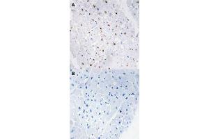 Immunohistochemical staining (Formalin-fixed paraffin-embedded sections) of human heart tissue with BLM (phospho T99) polyclonal antibody  without blocking peptide (A) or preincubated with blocking peptide (B) under 1:50-1:100 dilution. (BLM 抗体  (pThr99))