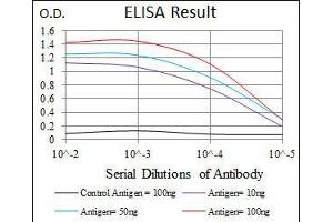 Black line: Control Antigen (100 ng), Purple line: Antigen(10 ng), Blue line: Antigen (50 ng), Red line: Antigen (100 ng), (Moesin 抗体)