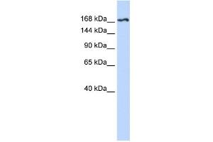 WB Suggested Anti-KDR Antibody Titration:  0. (VEGFR2/CD309 抗体  (N-Term))