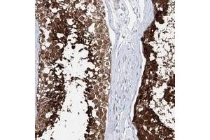 Immunohistochemical staining of human testis with C10orf53 polyclonal antibody  shows strong cytoplasmic positivity in cells in seminiferus ducts. (C10ORF53 抗体)