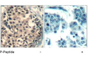 Image no. 2 for anti-HDAC4,HDAC5,HDAC9 (pSer220), (pSer246), (pSer259) antibody (ABIN319280) (HDAC4/HDAC5/HDAC9 抗体  (pSer220, pSer246, pSer259))