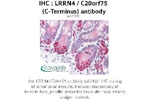 Image no. 1 for anti-Leucine Rich Repeat Neuronal 4 (LRRN4) (C-Term) antibody (ABIN1736586)