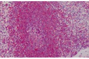 Human Spleen: Formalin-Fixed, Paraffin-Embedded (FFPE) (Peroxiredoxin 1 抗体  (AA 1-184))