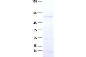 Western Blotting (WB) image for Mitochondrial Calcium Uptake 1 (MICU1) protein (His tag) (ABIN2713250)