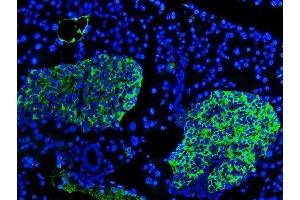 IF analysis of SYP using anti-SYP antibody (ABIN3042768). (Synaptophysin 抗体  (N-Term))