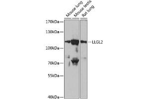 Western blot analysis of extracts of various cell lines, using LLGL2 antibody (ABIN6134714, ABIN6143260, ABIN6143263 and ABIN6217274) at 1:1000 dilution. (LLGL2 抗体  (AA 900-1000))