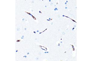 Immunohistochemistry of paraffin-embedded human brain using P Glycoprotein Rabbit mAb (ABIN7265732) at dilution of 1:100 (40x lens).