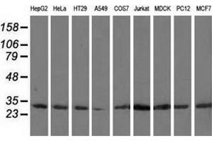 Western blot analysis of extracts (35 µg) from 9 different cell lines by using anti-CAPZA1 monoclonal antibody. (CAPZA1 抗体)