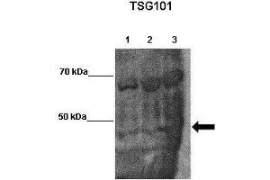 Western Blotting (WB) image for anti-Tumor Susceptibility Gene 101 (TSG101) (Middle Region) antibody (ABIN2780037)
