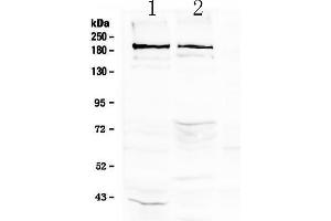 Western blot analysis of Neurocan using anti-Neurocan antibody . (Neurocan 抗体)