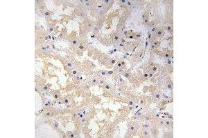 Immunohistochemical analysis of VIP staining in human kidney formalin fixed paraffin embedded tissue section. (Vip 抗体)