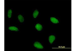 Immunofluorescence of purified MaxPab antibody to FLJ10379 on HeLa cell. (SRBD1 抗体  (AA 1-620))