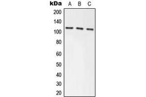 Western blot analysis of Axin-1 expression in HEK293T (A), NIH3T3 (B), PC12 (C) whole cell lysates. (Axin 抗体  (Center))