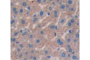 Immunohistochemistry (IHC) image for anti-Solute Carrier Family 27 (Fatty Acid Transporter), Member 5 (SLC27A5) (AA 471-689) antibody (ABIN1858807)