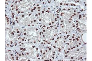 Immunohistochemical staining of paraffin-embedded Human Kidney tissue using anti-EXOSC7 mouse monoclonal antibody. (EXOSC7 抗体)