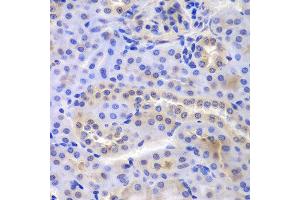 Immunohistochemistry of paraffin-embedded mouse kidney using PSMA6 antibody at dilution of 1:100 (400x lens). (PSMA6 抗体)