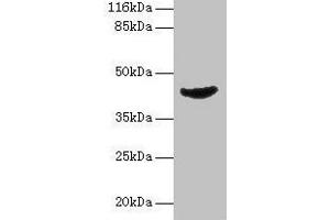 Western blot All lanes: ADA antibody at 2 μg/mL + Jurkat whole cell lysate Secondary Goat polyclonal to rabbit IgG at 1/10000 dilution Predicted band size: 41 kDa Observed band size: 41 kDa (ADA 抗体  (AA 157-343))