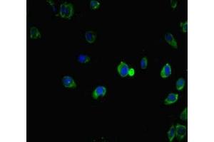 Immunofluorescent analysis of Hela cells using ABIN7156623 at dilution of 1:100 and Alexa Fluor 488-congugated AffiniPure Goat Anti-Rabbit IgG(H+L) (IRF5 抗体  (AA 214-395))