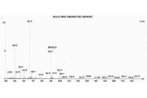 Image no. 1 for Procollagen III N-Terminal Propeptide (PIIINP) (N-Term) peptide (Ovalbumin) (ABIN5666357) (Procollagen III N-Terminal Propeptide (PIIINP) (N-Term) peptide (Ovalbumin))