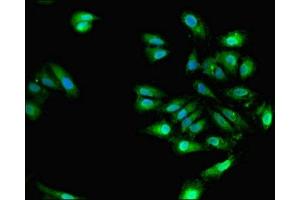 Immunofluorescent analysis of Hela cells using ABIN7151487 at dilution of 1:100 and Alexa Fluor 488-congugated AffiniPure Goat Anti-Rabbit IgG(H+L) (ELAVL4 抗体  (AA 1-150))