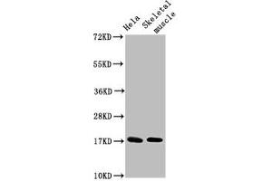 Western Blot Positive WB detected in: Hela whole cell lysate, Rat skeletal muscle tissue All lanes: UBE2D3 antibody at 4. (UBE2D3 抗体  (AA 1-147))
