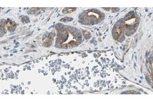 ABIN6274956 at 1/100 staining Human prostate tissue by IHC-P. (CA1 抗体  (Internal Region))