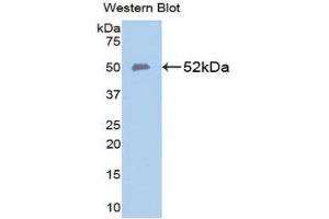 Western Blotting (WB) image for anti-Solute Carrier Family 40 (Iron-Regulated Transporter), Member 1 (SLC40A1) (AA 127-321) antibody (ABIN1111115) (SLC40A1 抗体  (AA 127-321))