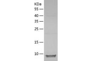 CCL27 Protein (AA 25-112) (His tag)