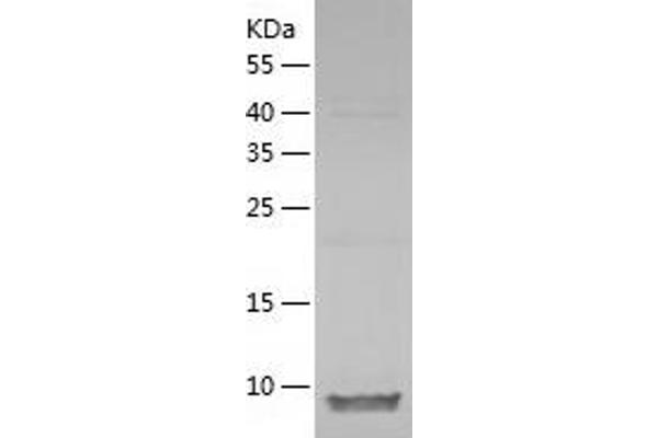 CCL27 Protein (AA 25-112) (His tag)