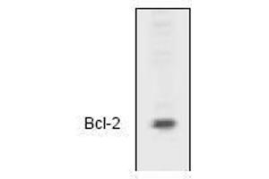Image no. 1 for anti-B-Cell CLL/lymphoma 2 (BCL2) (N-Term) antibody (ABIN126981) (Bcl-2 抗体  (N-Term))
