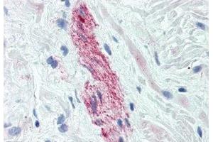 Image no. 3 for anti-Nestin (NES) antibody (ABIN108568) (Nestin 抗体)