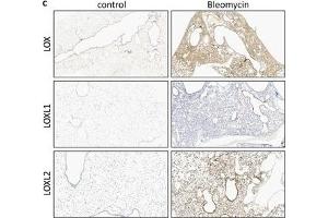 Immunohistochemistry (Paraffin-embedded Sections) (IHC (p)) image for anti-Lysyl Oxidase-Like 2 (LOXL2) antibody (ABIN2856034)