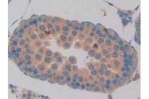 Detection of CCL6 in Rat Testis Tissue using Polyclonal Antibody to Chemokine (C-C motif) ligand 6 (CCL6) (CCL6 抗体  (AA 21-115))